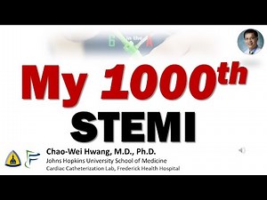 My 1000th STEMI - Angiojet of Ectatic RCA