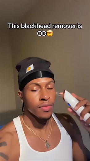 Flexify Store on Instagram: "Easy-To-Clean Design Derma Suction Facial Cleanser Description: The Derma Suction Facial Cleanser features an easy-to-clean design that makes skincare simple and hygienic. Its powerful yet gentle suction removes dirt, oil, and blackheads while the detachable, washable components ensure quick cleaning after every use. Perfect for maintaining smooth, refreshed, and glowing skin with minimal effort. #DermaSuction #FacialCleanser #EasyToClean #SkincareTools #BlackheadRem