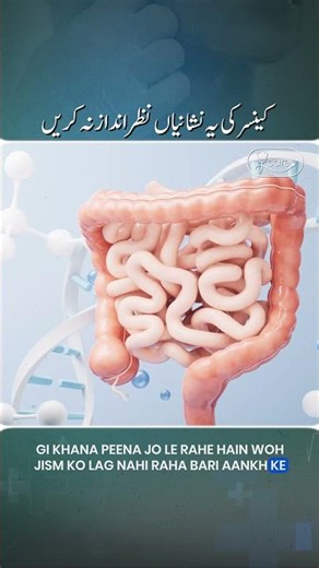 Warning Signs of Stomach and Gut Cancer You Should Never Ignore #StomachCancer #GutHealth