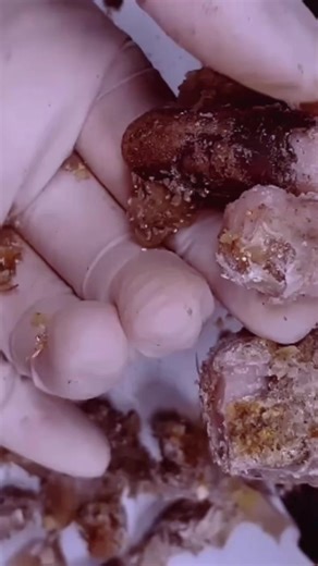 How to cut nails#nails #nail #nailart #nailpolish #nailswag #nailstagram #naildesign #nailsofinstagram | Dii Doctor