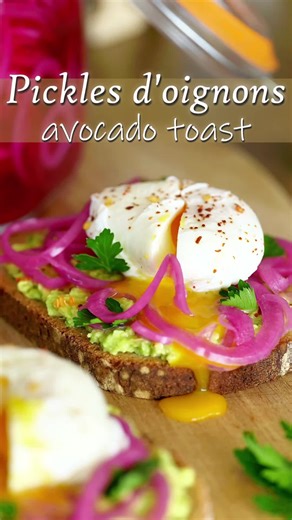 🌸 Pickles d’oignons rouges express Envie d’apporter du peps, de la couleur et du croquant à tes plats en quelques minutes ? Ces pickles d’oignons rouges sont la solution parfaite 🥑✨ 🧅 Ingrédients ✔️ 1 oignon rouge ✔️ Eau chaude (environ les 3/4 du bocal) ✔️ Vinaigre de cidre (compléter le bocal) ✔️ 1 c. à café de sel ✔️ 1 c. à soupe de sucre 👨‍🍳 Préparation ➡️ Émince finement l’oignon à la mandoline. ➡️ Dépose-le dans un bocal hermétique. ➡️ Ajoute l’eau chaude puis complète avec le vinaigr