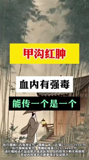 甲沟红肿，这个方法简单有效，能帮一个是一个 #甲沟炎 #甲沟 #甲沟红肿 #嵌甲 #甲沟炎红肿疼怎么处理