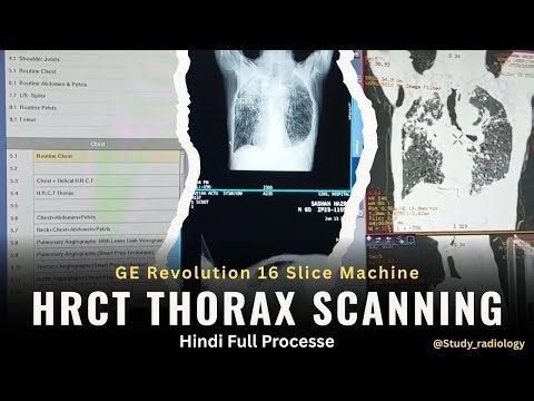 HRCT Scanning On GE Revolution 16 Slice Machine | Full Process in Hindi | @Study_Radiology