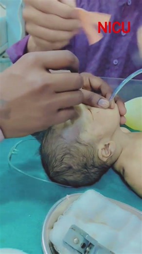 Intubation in Neonatal Care
