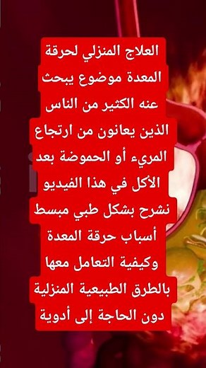 العلاج المنزلي لحرقة المعده