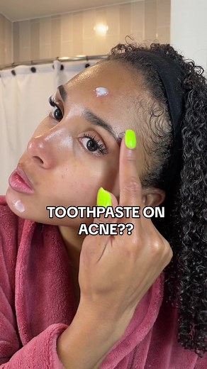 Replying to @Akira Smith honestly I need a miracle at this point 😭😩 #acne #acnebreakout #acneskin #acnespottreatment #pimple #acneproneskin #acnetips