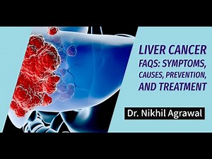 Liver Cancer FAQs: Symptoms, Causes, Prevention, and Treatment | Dr. Nikhil Agrawal