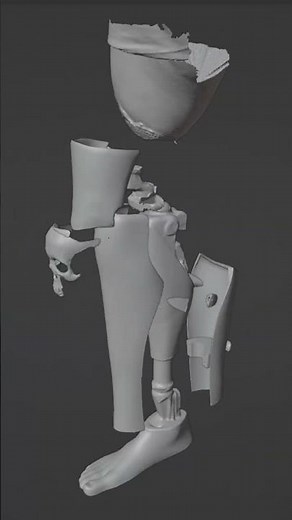 3D Printed Prosthetic Leg Cover