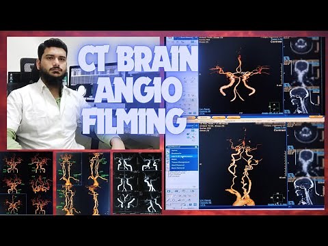 CT SCAN BRAIN ANGIOGRAPHY FILMING PROCESS ON PHILIPS INGENUITY MACHINE SOFTWARE | Circle of willis