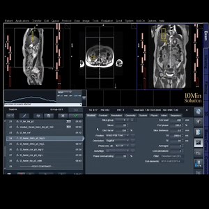 How to MRI of Whole Abdomen Planning & Protocol step by step guide. | Muktadir Rahman