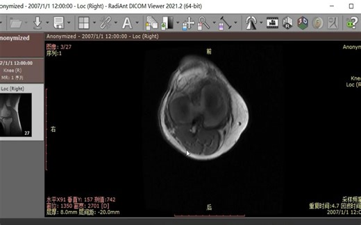 RadiAnt DICOM Viewer 医学影像浏览安装包一键安装下载教程 零基础也能掌握