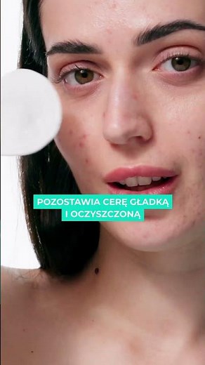 New Bielenda Acne Remedium Set: Pore Cleansing Spatula and Concentrate! #skincare