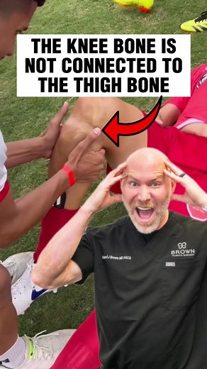 Anterior Drawer Test for ACL Injury: Proper Technique Revealed