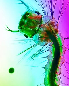 This guy examined all the different types of water he had access too to see what lurks within 🧐 💧 | UNILAD