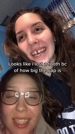 if you knew me from 2018-2019 I’m sorry. Vc- @mindfuuckk #gap #expander #foryou