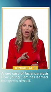TONIGHT AT 10: Susan-Elizabeth Littlefield reports on a boy who can’t smile due to a rare condition. She finds how young Liam has learned to express himself. | WCCO & CBS News Minnesota