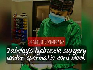 Jabolay's hydrocele surgery under spermatic cord block