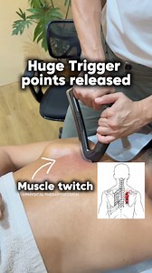 What the knot between your shoulder blades need 🤩🤩🤩 #rhomboids #backpainrelief #iastm #scraping #OMG #trendingreelsvideo | Physical Therapy Session
