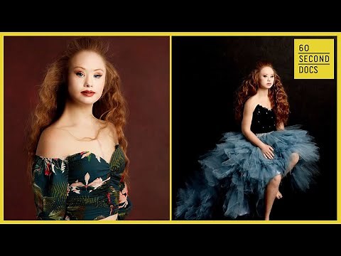 Madeline Stuart, World’s 1st Professional Model w/ Down Syndrome