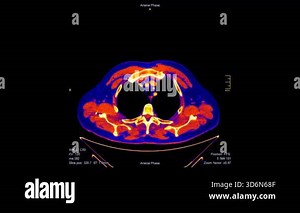 Detailed animation of colorful computed tomography (CT) scan slices. Visualization of a male human's anatomy for medical diagnosis or high-tech concepts