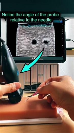 usm - how to follow the needle.mp4