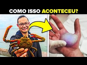 Ele foi Beliscado por um Caranguejo. 4 Dias Depois, Ele Faleceu Dormindo