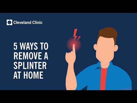 5 Ways To Remove a Splinter at Home