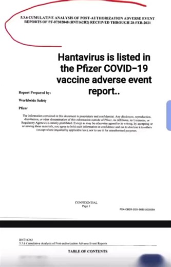 💉 การพัฒนาของการติดเชื้อ Hantavirus (ไวรัสฮันตา) เป็นเหตุการณ์ไม่พึงประสงค์ที่ทราบกันดีซึ่งเกิดจากวัคซีน COVID-19 ของ Pfizer📤 ควรแชร์ส่งต่อสิ่งนี้ให้สังคมได้รับรู้...#Hantavirus #ไวรัสฮันตา #COVID19 #โควิด19