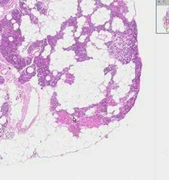 Shotgun Histology Parathyroid