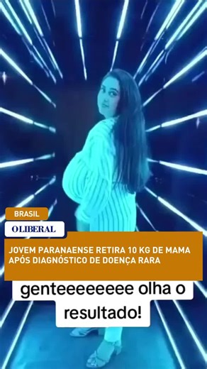 Mudança de Vida: Thaynara Marcondes e sua Cirurgia de Redução