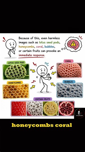Trypophobia