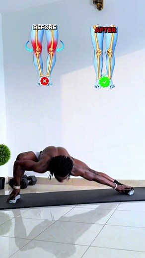 How to Get Rid of Knock Knees at Home: A Beginner's Guide