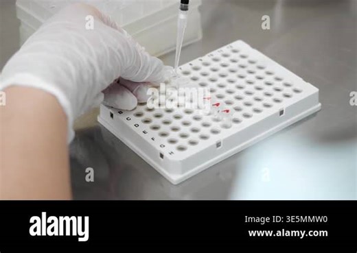 Laboratory technician transferring liquid samples using pipette into tubes on rack during sample preparation process in clinical lab Stock Video Footage - Alamy