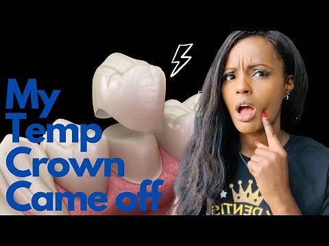Temporary Crown Came off: 3 ways to fix