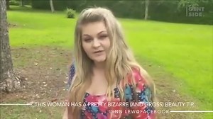This Woman Claims Drinking Dog Urine Cleared Up Her Acne