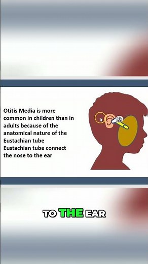 Otitis Media Explained: Why Kids Get Ear Infections More #shorts