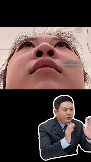 Do鼻必看 鼻孔大有什么好的解决办法？ #do鼻必看 #隆鼻科普 #鼻孔大怎么办 #南京嵇海龙 #南京隆鼻