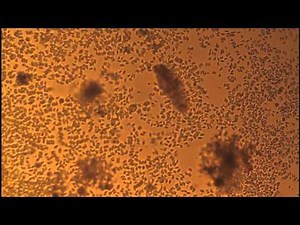 Rotifer moving (Rotaria rotatoria)