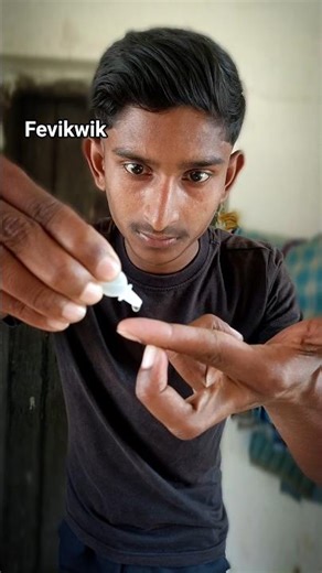 I Put Fevi Kwik on My Fingers… Now They’re STUCK! 🫣 #shorts #experiment