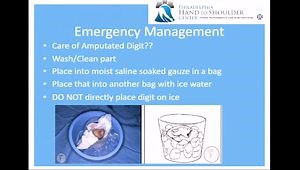 The Mangled Hand: High Energy Laceration, Crush or Avulsion Injuries