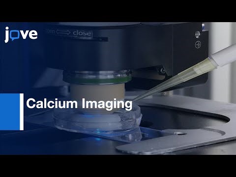 Calcium Imaging to Visualize Brain Responses to Endocrine Signaling | Protocol Preview