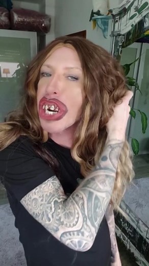 👀 keeping my retainer on #fyp #funny #retainers #teeth | Michael Samaan