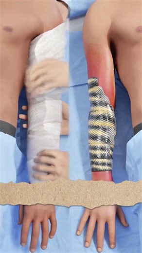 Sais-tu comment la peau de poisson soigne les brûlures ? 😱🔥#shorts