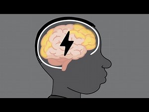 HEADS UP to Sports Officials: Concussion Basics