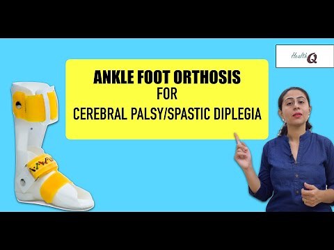 Things you should know about ANKLE FOOT ORTHOSIS