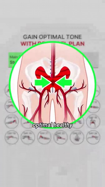 Achieve Better Control with Dr. Kegel's Personal Plan