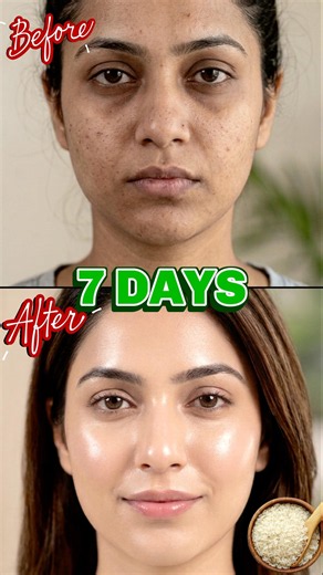 DIY Rice face serum for bright & glowing skin ✨ #ashortaday #7daychallenge