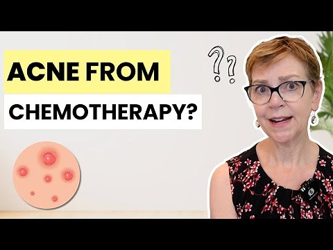 Chemo Acne & Sores: Everything You Need to Know