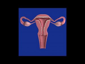 Gebärmutterhalskrebs Zervixkarzinom