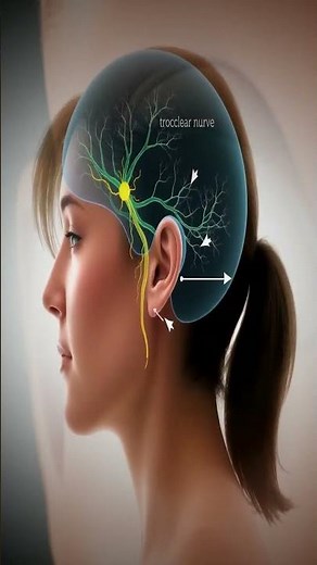 The Hidden Gem of Eye Movement: The Trochlear Nerve